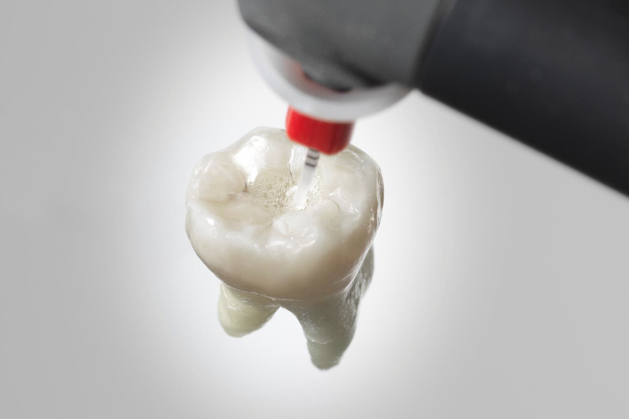 Smartlite® Pro EndoActivator in use