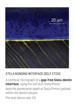 A confocal micrograph of a gap-free Stela-dentin interface