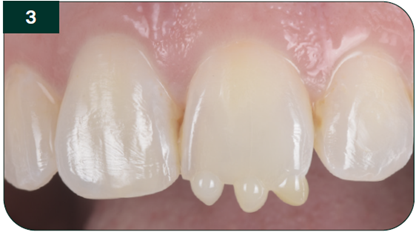 Continued shade comparisons 