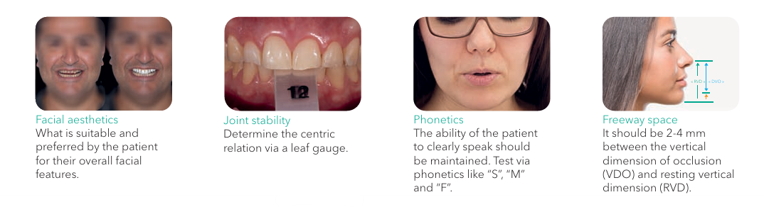 A diagram provided by GC regarding the considerations when making a treatment plan for severe wear