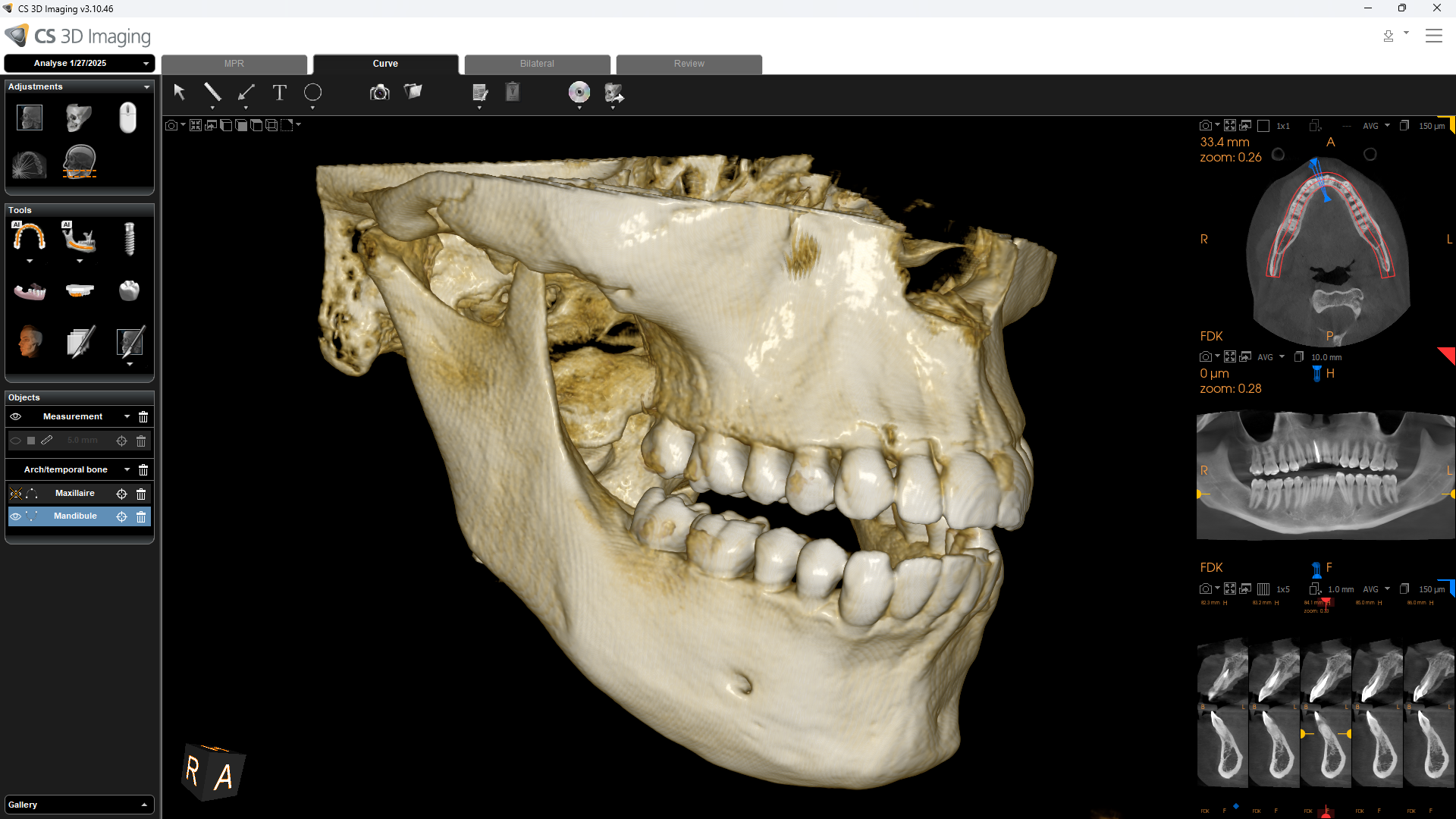 Carestream CS8200 sample image