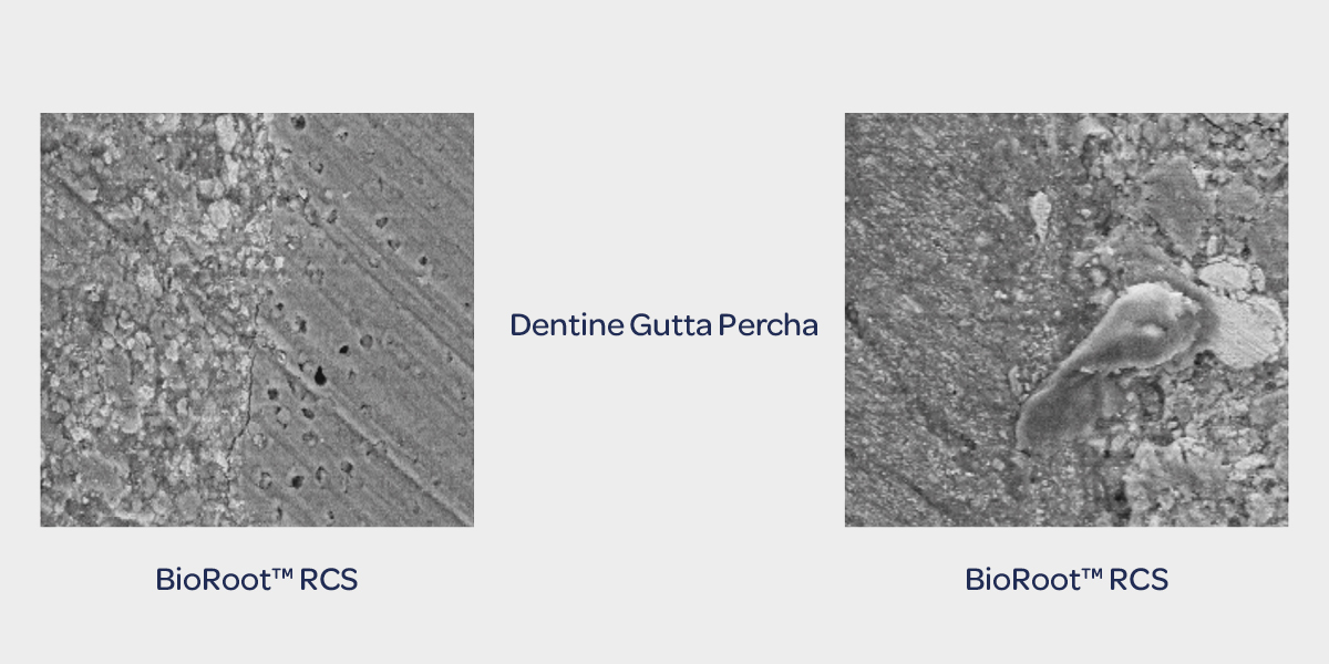 DentineGuttaPercha.jpg