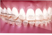 Reverse Curve G4 NiTi Tooth-Coloured  .019x.025 Upper 