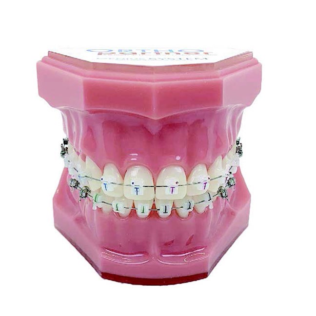 Genius Crystal SLB U5-5 L3-3 Typodont