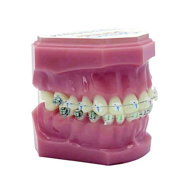 Genius Crystal SLB U5-5 L3-3 Typodont