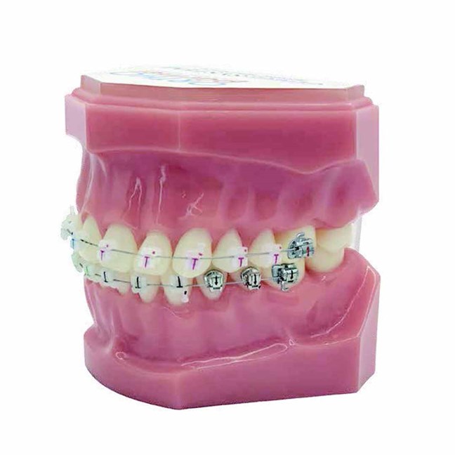 Genius Crystal SLB U5-5 L3-3 Typodont