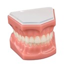 Consultation Model with Brackets 