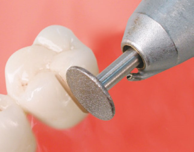 Sintered Diamond Disc Crown Separator RA 5114 080