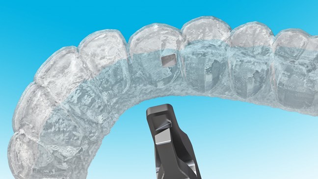 Clear Collection Counter Clockwise Wedge