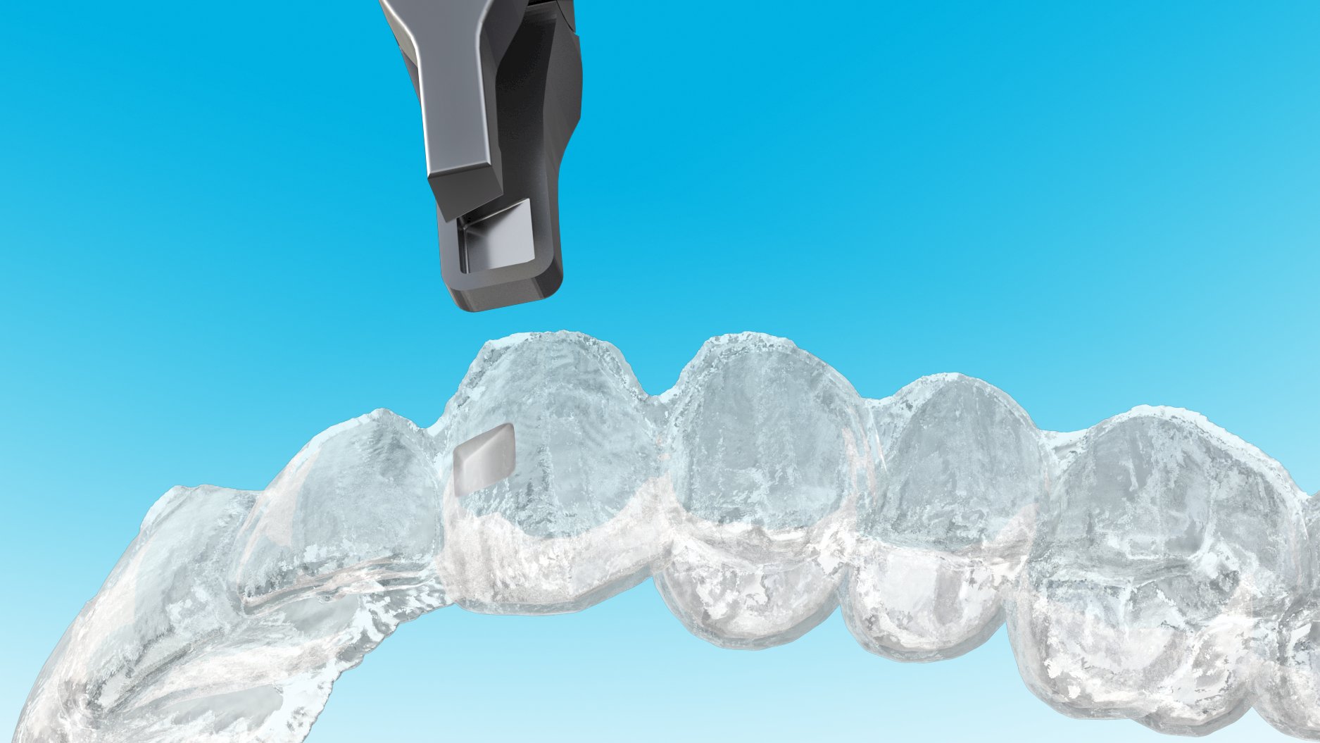 DPI568 Clear Collection Counter Clockwise Wedge