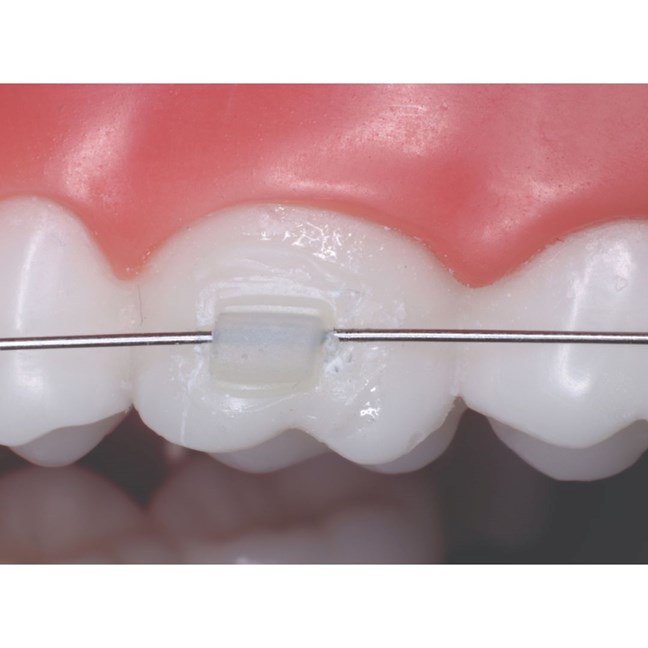 Reliamold Tube Attachment