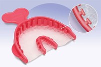 T-Loc Triple Trays 3/4 Arch 