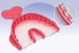 T-Loc Triple Trays 3/4 Arch