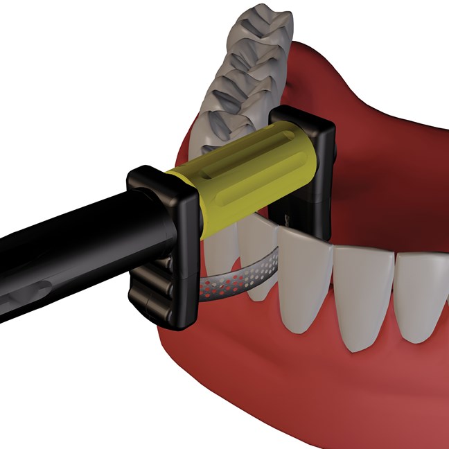 ProxyMate Refills Double-Sided Super Fine