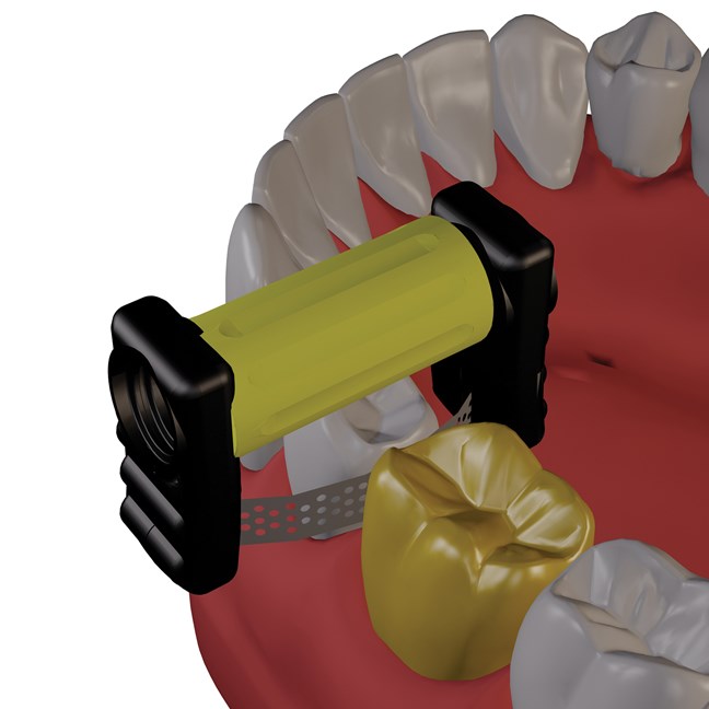 ProxyMate Refills Double-Sided Super Fine