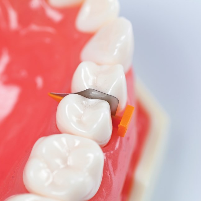 FenderWedge Value Pack - Medium - Green