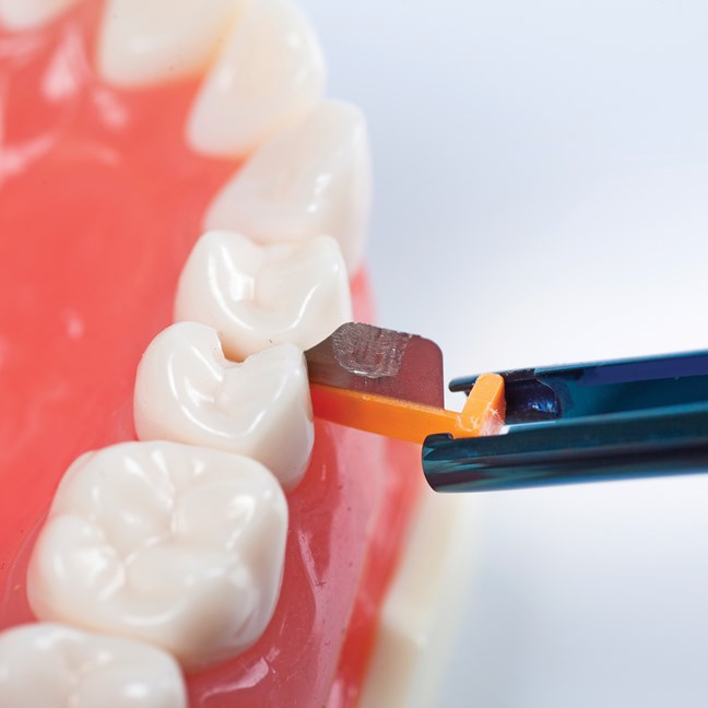 FenderWedge Value Pack - Large - Yellow