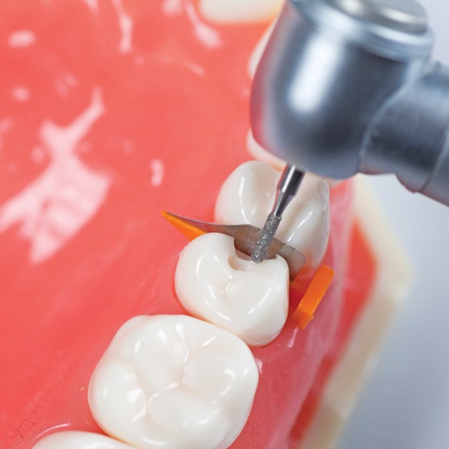 FenderWedge Value Pack - Large - Yellow