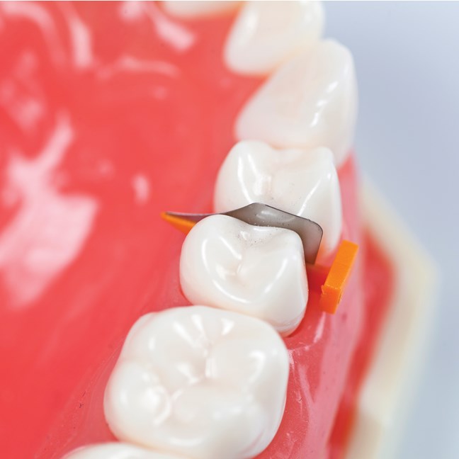 FenderWedge Value Pack - X-Small - Purple