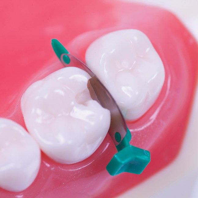 FenderMate Left Regular - Green