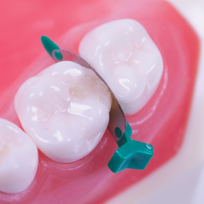 FenderMate Left Regular - Green