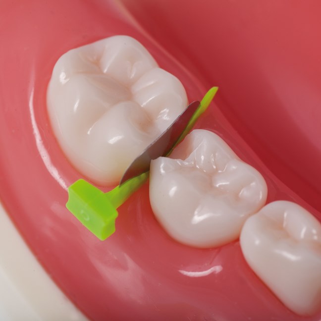 FenderMate Prime Short - Neon Yellow