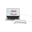 iTero Element 5D Laptop CPO (1 Year Plan) 