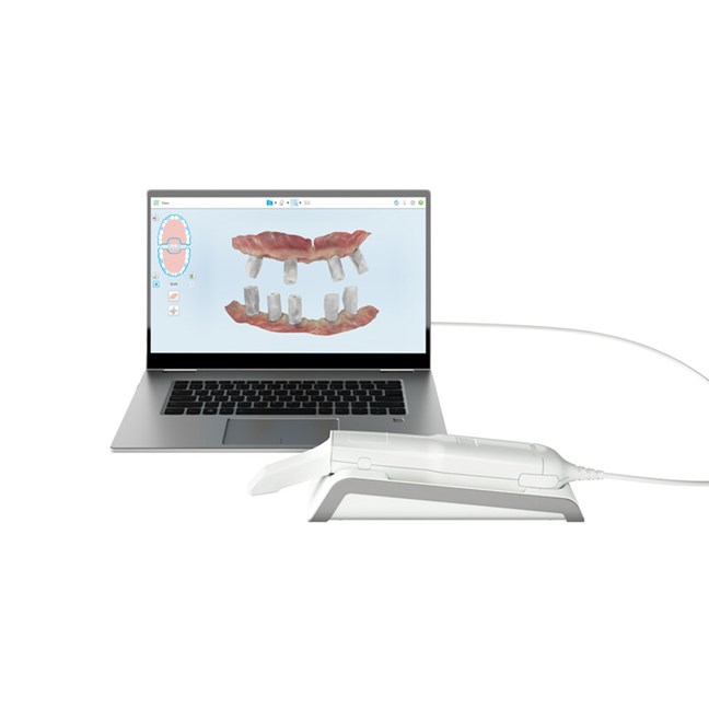 iTero Element 5D Laptop CPO (1 Year Plan)