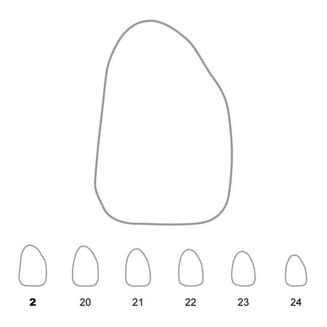 Temporary Crowns Upper Lateral Incisors Right 2