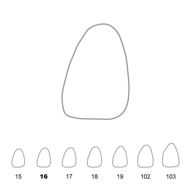 Temporary Crowns Upper Central Incisors Left 16