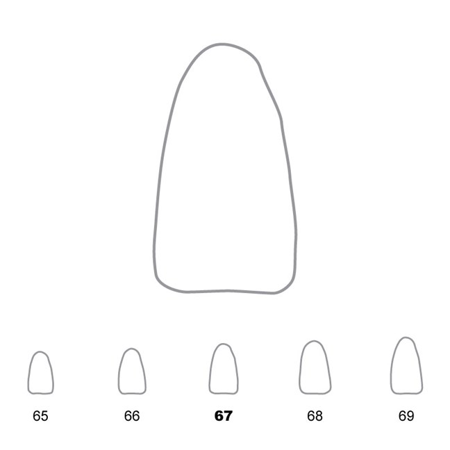 Temporary Crowns Lower Incisors 67