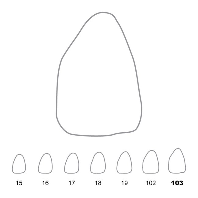 Temporary Crowns Upper Central Incisors Left 103
