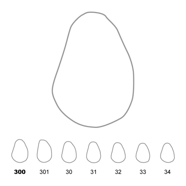 Temporary Crowns Upper Canines Right 300