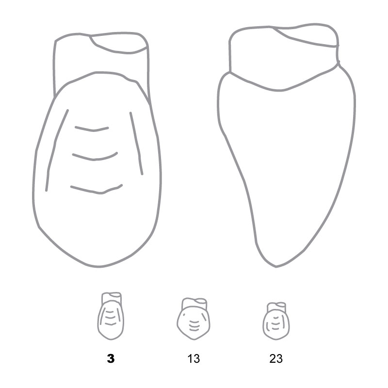TDO003 Odus Pella Transparent Crown Forms Canines 3