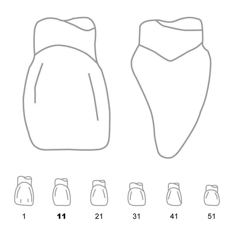 TDO011 Odus Pella Transparent Crown Forms Centrals 11